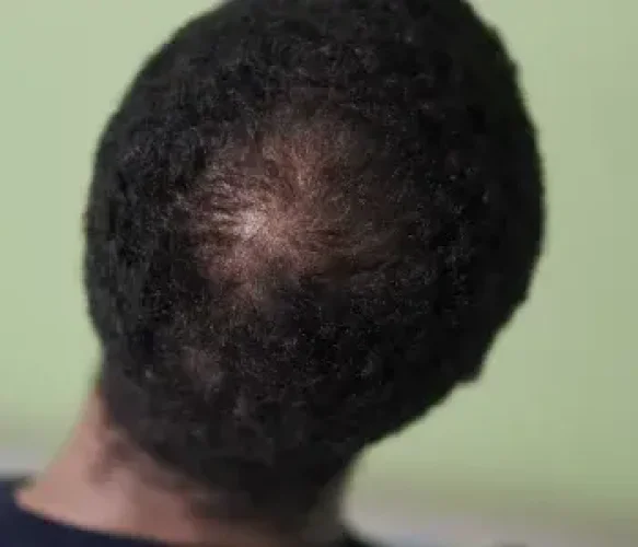 3489d66b36d3a3b67cd3367975f4a963edcd12e2-350x300